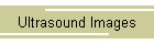 Ultrasound Images