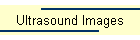 Ultrasound Images